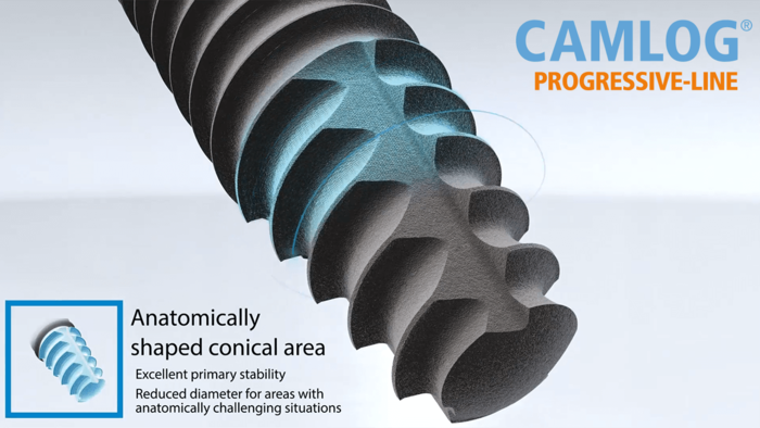 CAMLOG PROGRESSIVE-LINE Animation