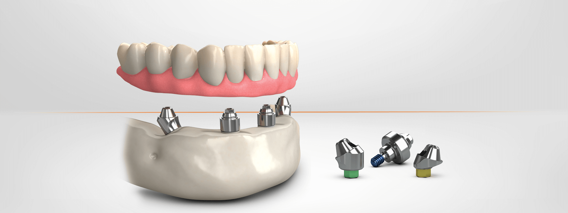 BioHorizons TeethXpress Overview Banner