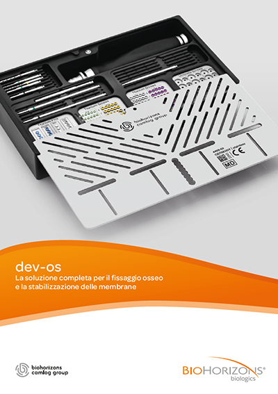 dev-os Volantino prodotti dev-os Volantino prodotti: dev-os – La soluzione completa per il fissaggio osseo e la stabilizzazione delle membrane